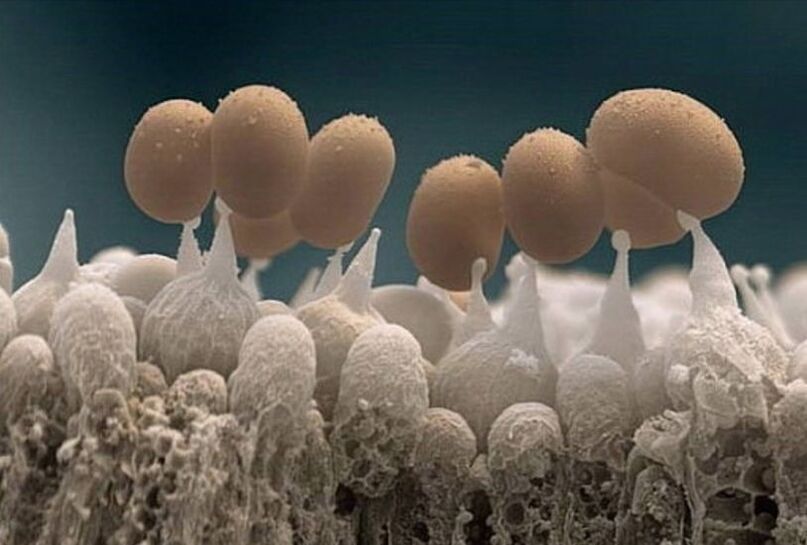 hongos en las uñas de los pies bajo un microscopio