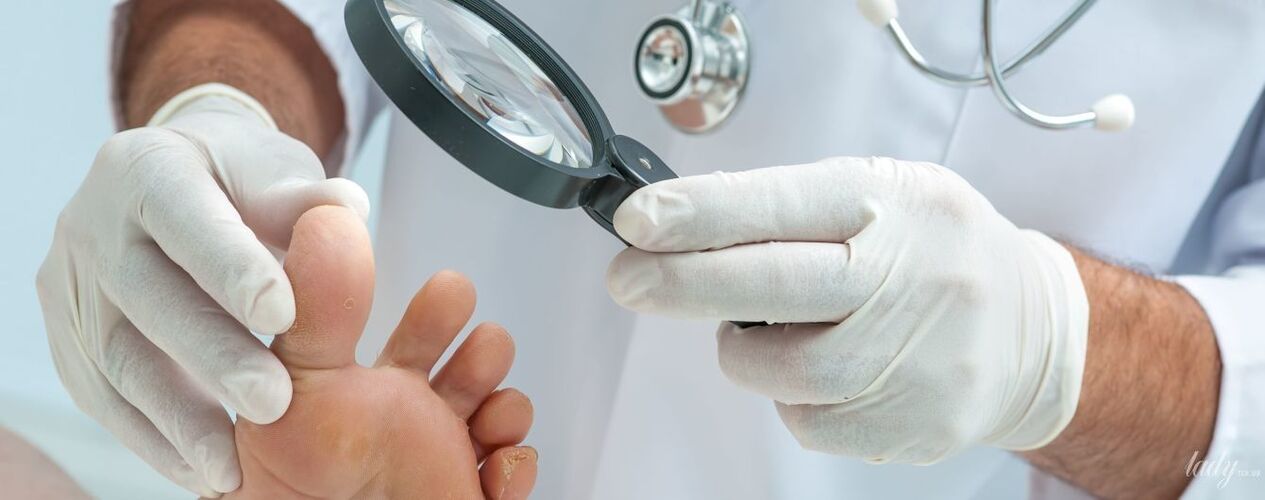 El médico examina el hongo en el dedo del pie