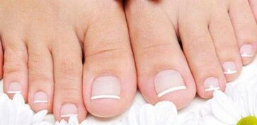 Prevención de la aparición del hongo en las uñas de las piernas