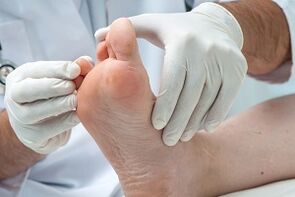 El médico examina los pies en busca de hongos en los dedos.